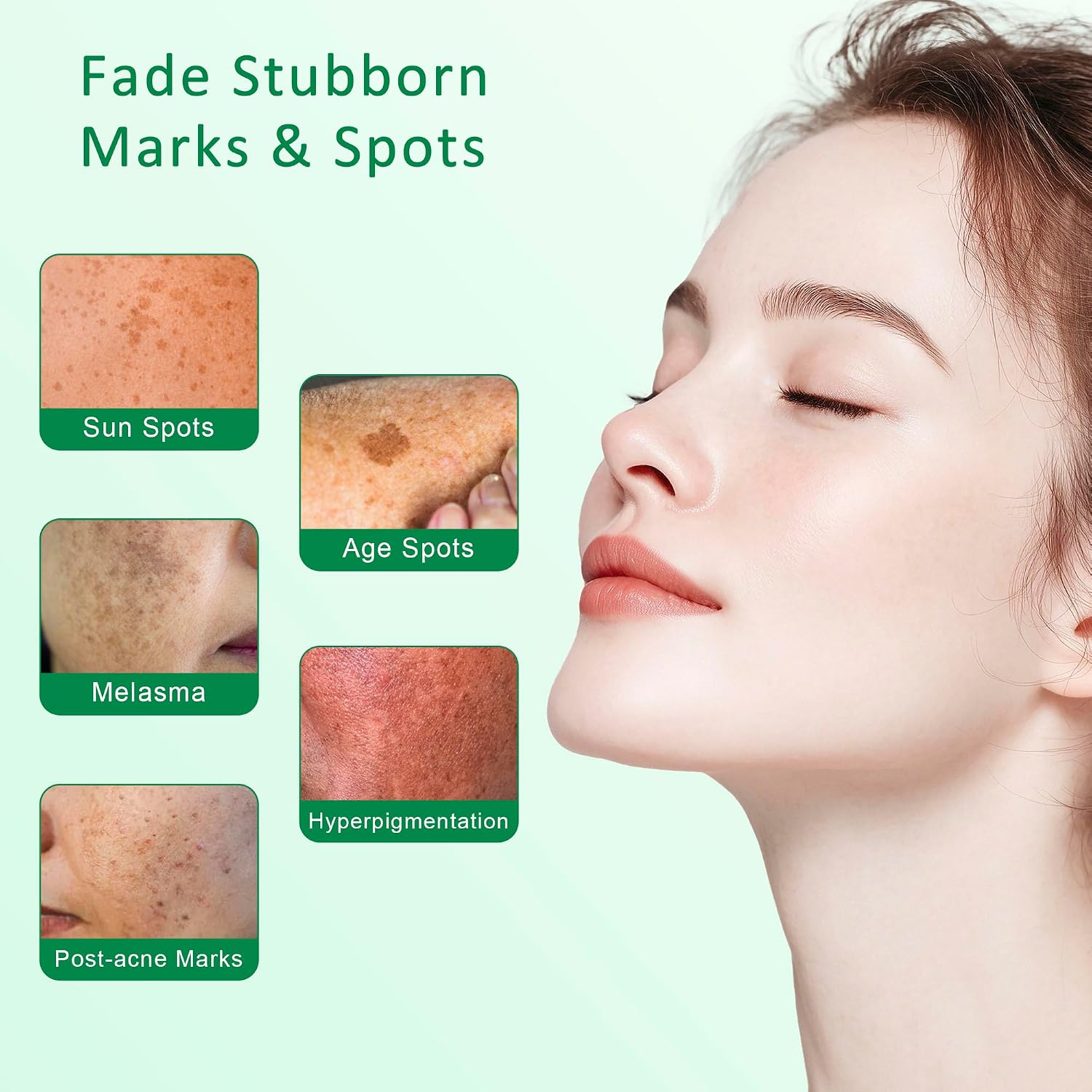 Dark Spot Remover for Face & Body, Light... 10 Dark Spot Remover for Face & Body, Light... - Image 10