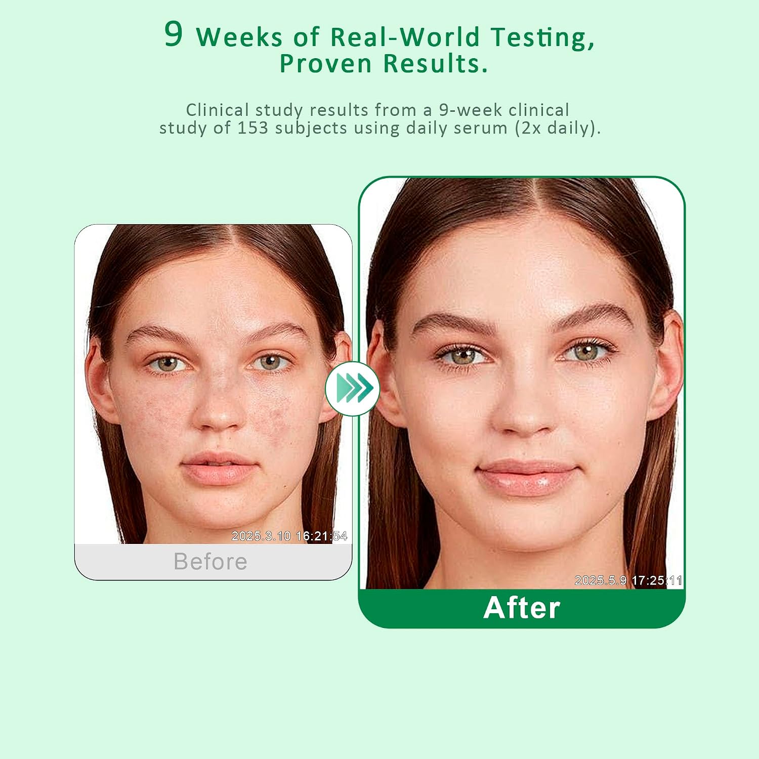 Dark Spot Remover for Face & Body, Light... 3 Dark Spot Remover for Face & Body, Light... - Image 3