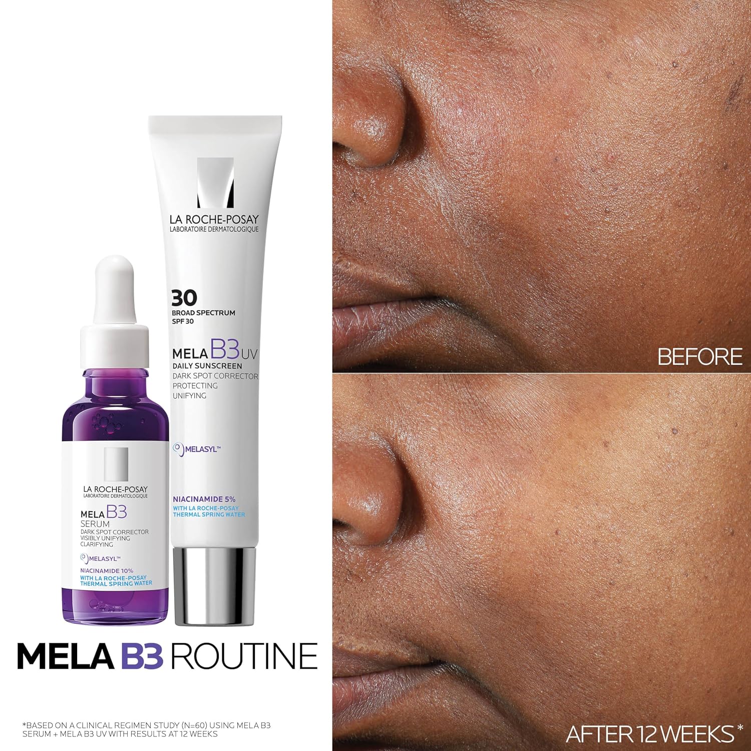 La Roche-Posay Mela B3 Serum, Dark Spot ... 7 La Roche-Posay Mela B3 Serum, Dark Spot ... - Image 7