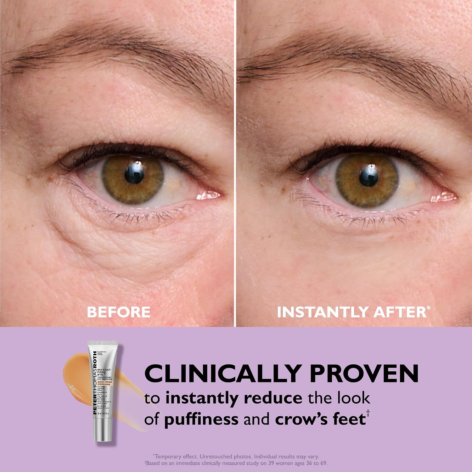 Peter Thomas Roth | Instant FIRMx® Eye T... 5 Peter Thomas Roth | Instant FIRMx® Eye T... - Image 5