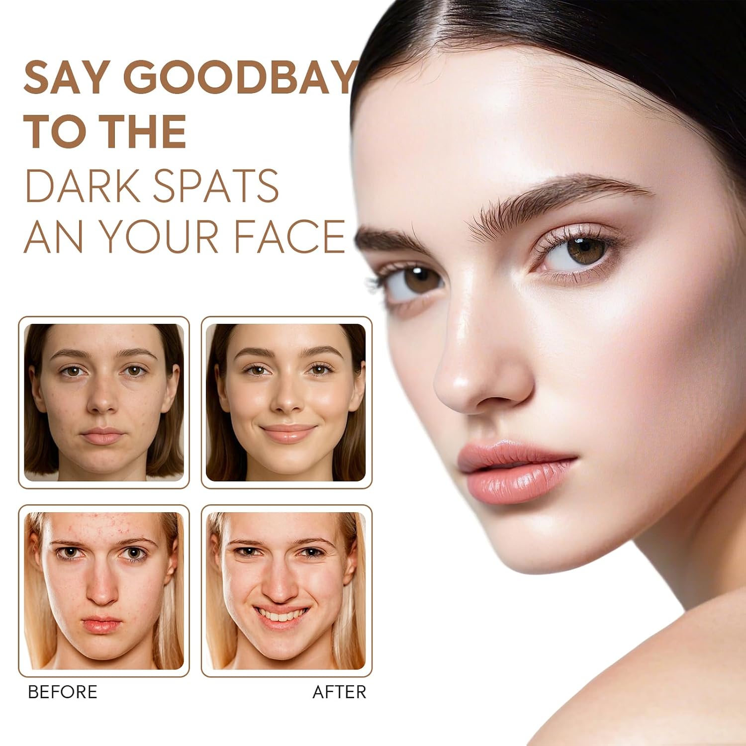Dark Spot Remover For Face Body: Kojic A... 6 Dark Spot Remover For Face Body: Kojic A... - Image 6
