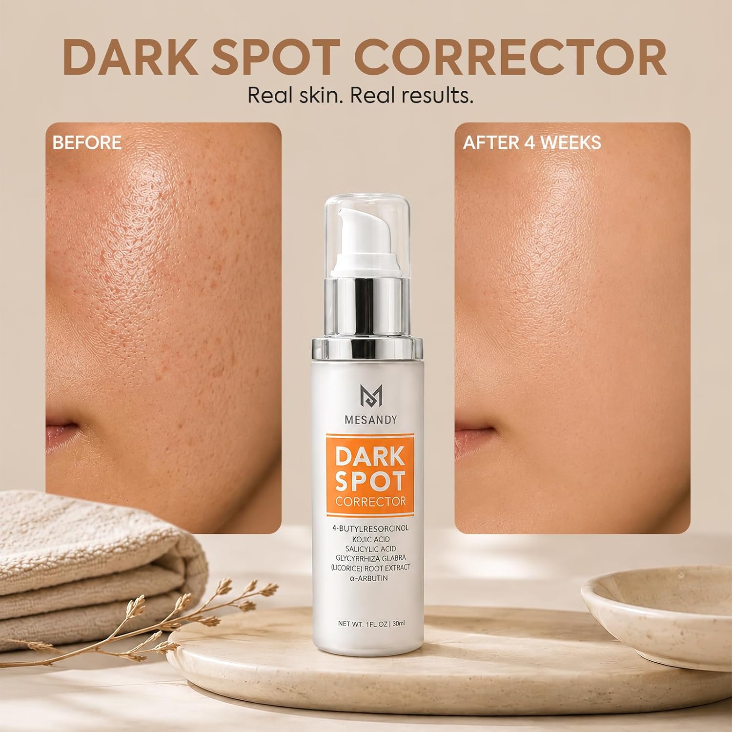 Dark Spot Remover For Face Body: Kojic A... 3 Dark Spot Remover For Face Body: Kojic A... - Image 3