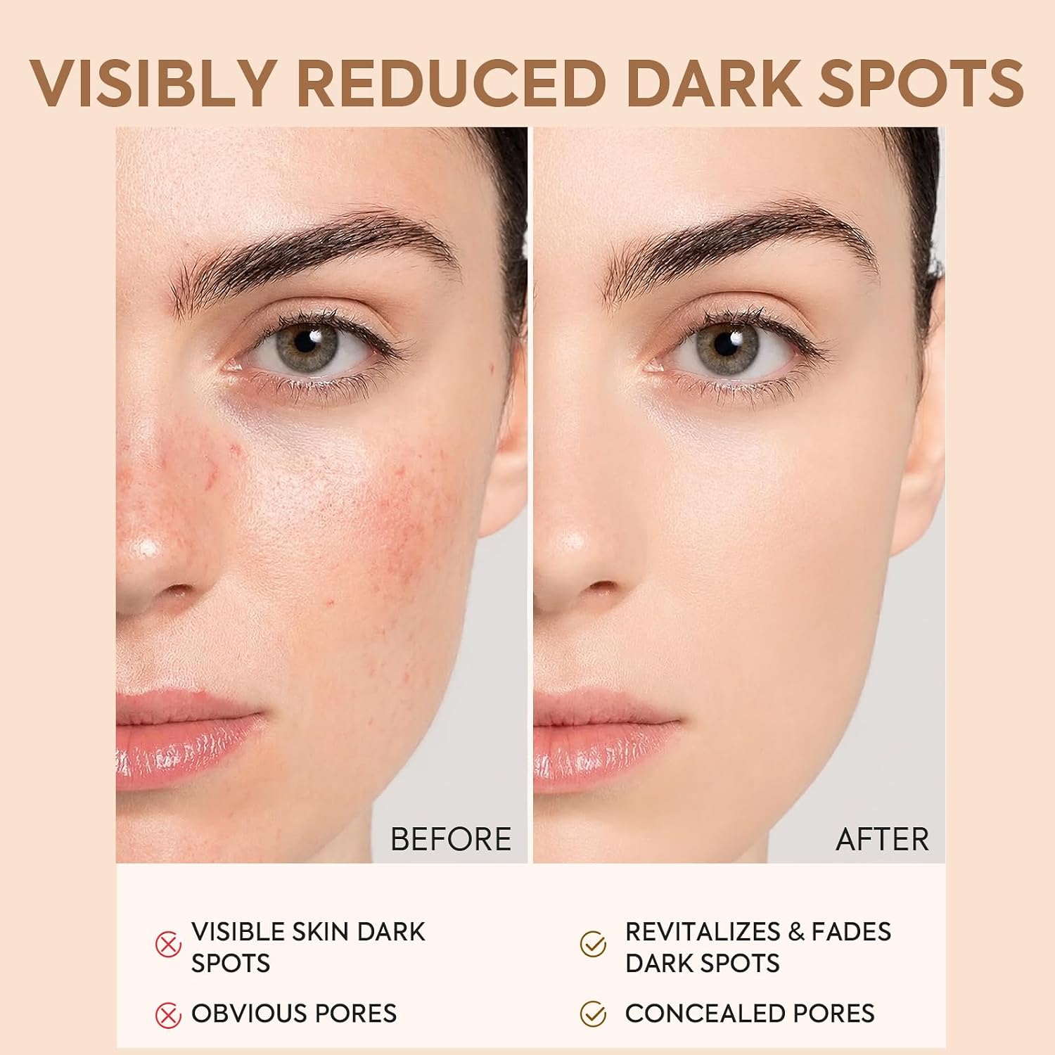 Dark Spot Remover For Face Body: Kojic A... 5 Dark Spot Remover For Face Body: Kojic A... - Image 5