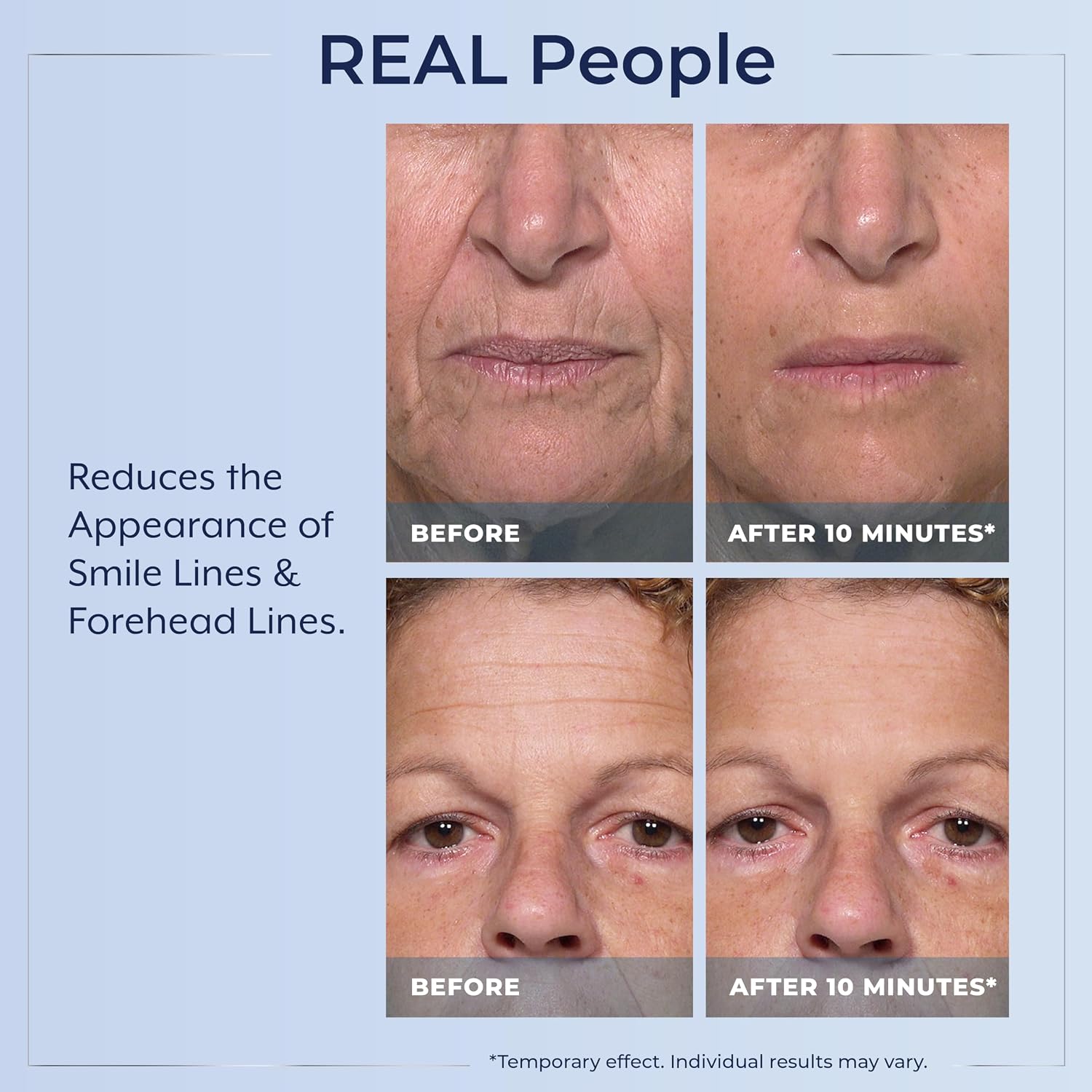 Plexaderm Eye Serum Pump - Visibly Reduc... 5 Plexaderm Eye Serum Pump - Visibly Reduc... - Image 5