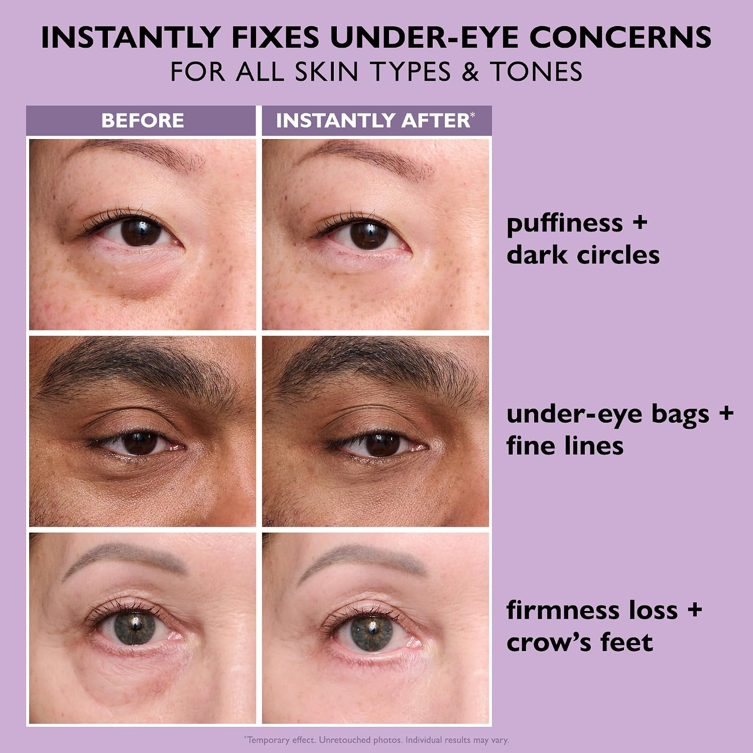 Peter Thomas Roth | Instant FIRMx® Eye T... 8 Peter Thomas Roth | Instant FIRMx® Eye T... - Image 8