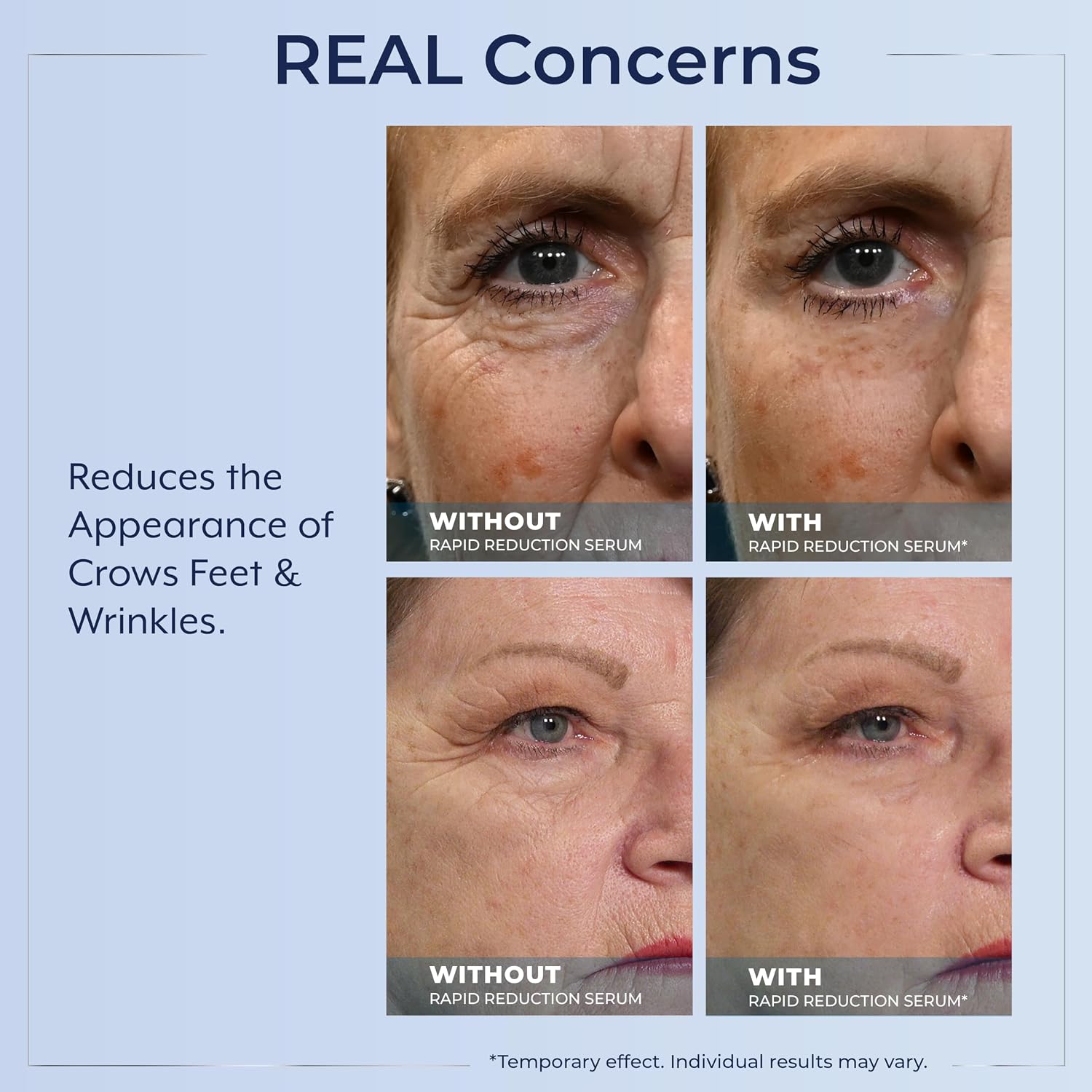 Plexaderm Eye Serum Pump - Visibly Reduc... 6 Plexaderm Eye Serum Pump - Visibly Reduc... - Image 6