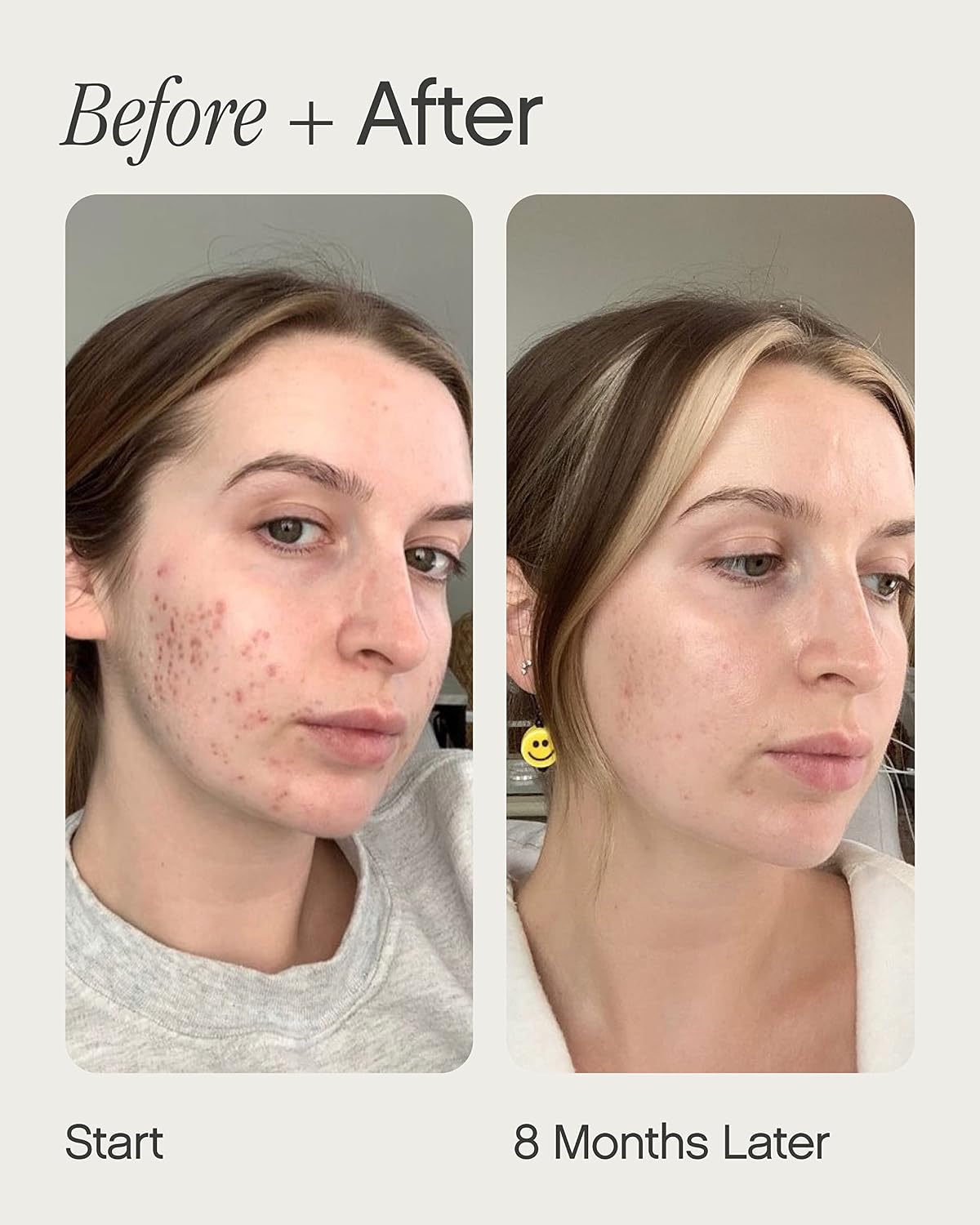 Topicals, Faded Brightening Serum, Reduc... 5 Topicals, Faded Brightening Serum, Reduc... - Image 5