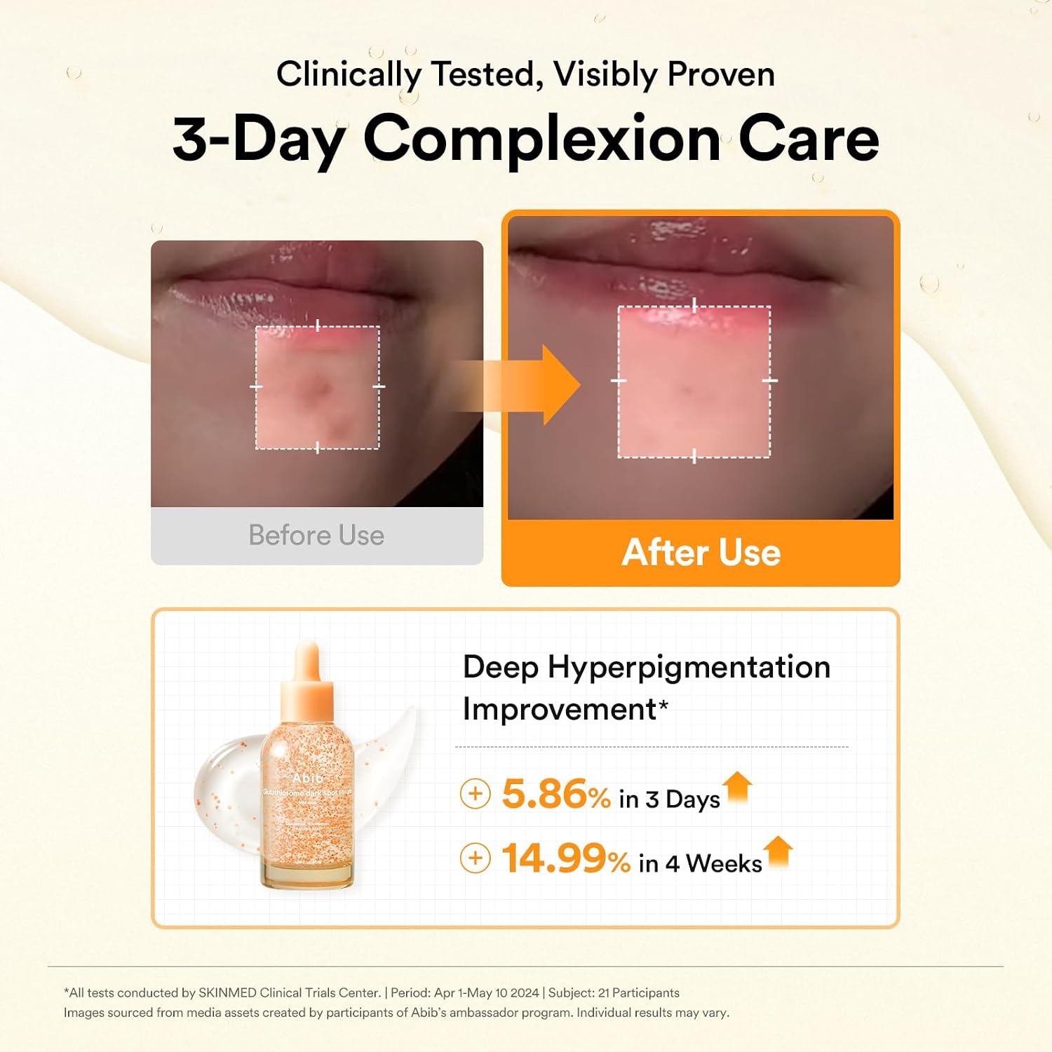 Abib Glutathiosome Dark Spot Serum Vita ... 4 Abib Glutathiosome Dark Spot Serum Vita ... - Image 4