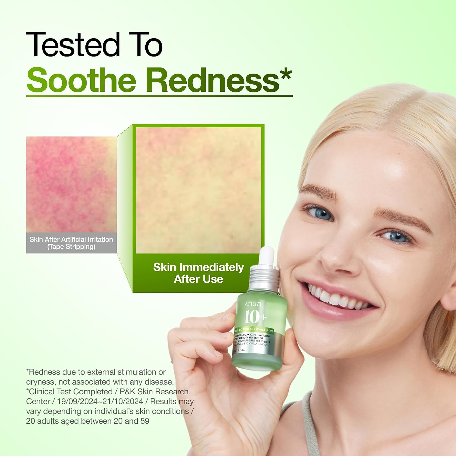 Anua Azelaic Acid 10 Hyaluron Redness So... 6 Anua Azelaic Acid 10 Hyaluron Redness So... - Image 6