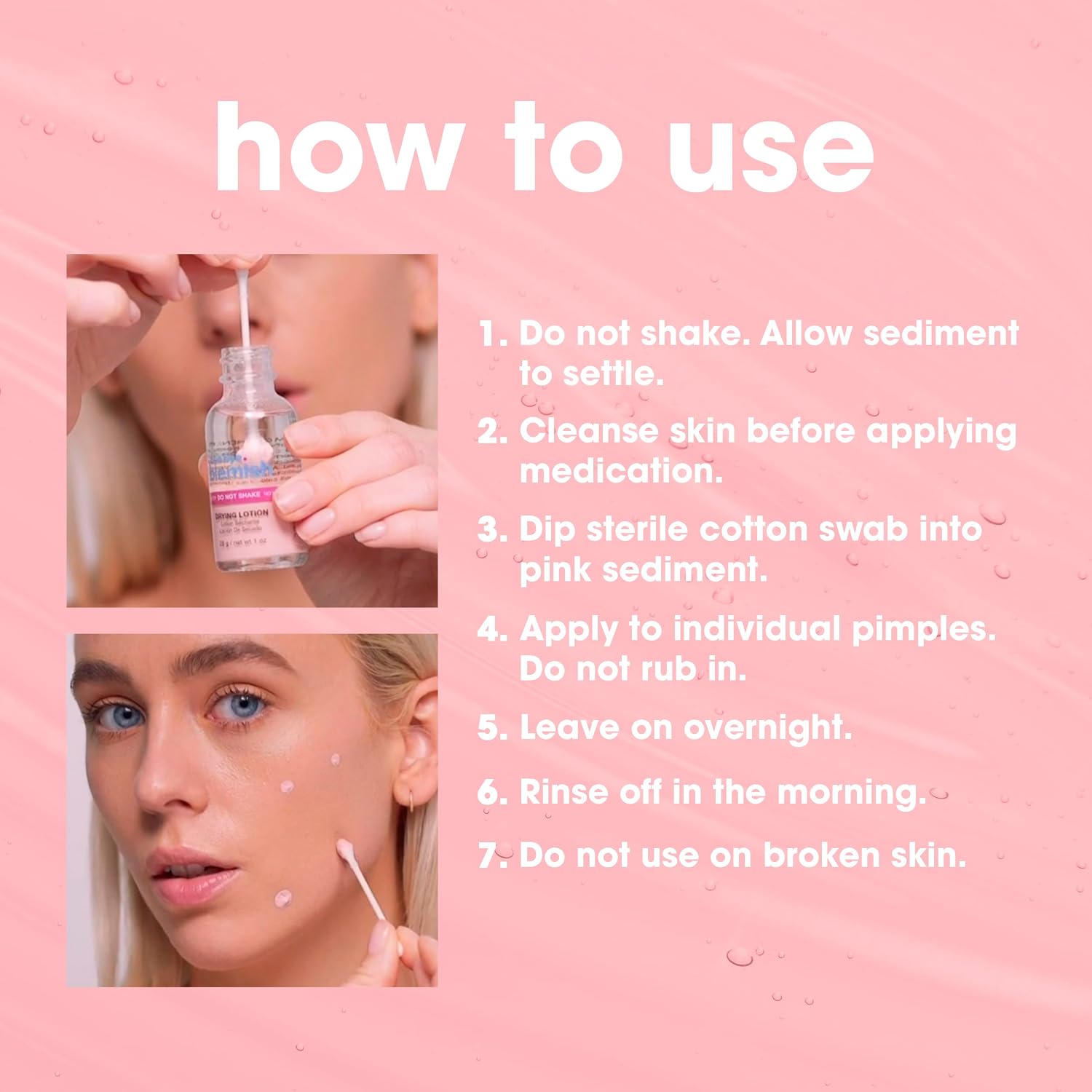 Bye Bye Blemish Acne Drying Lotion, Redu... 6 Bye Bye Blemish Acne Drying Lotion, Redu... - Image 6