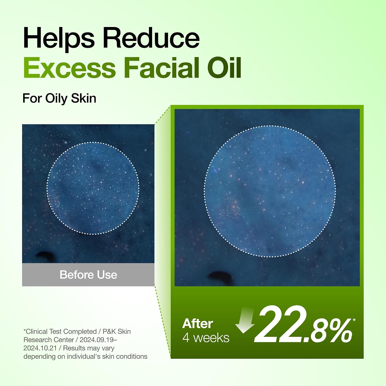 Anua Azelaic Acid 10 Hyaluron Redness So... 7 Anua Azelaic Acid 10 Hyaluron Redness So... - Image 7