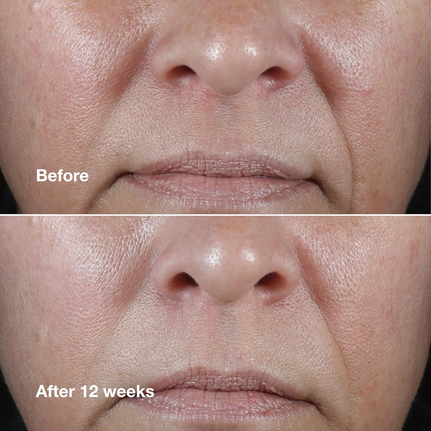Clinique Smart Clinical Repair Wrinkle C... 4 Clinique Smart Clinical Repair Wrinkle C... - Image 4
