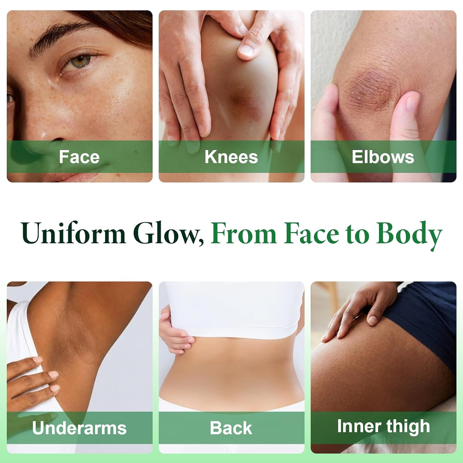 Dark Spot Remover for Face & Body with N... 7 Dark Spot Remover for Face & Body with N... - Image 7
