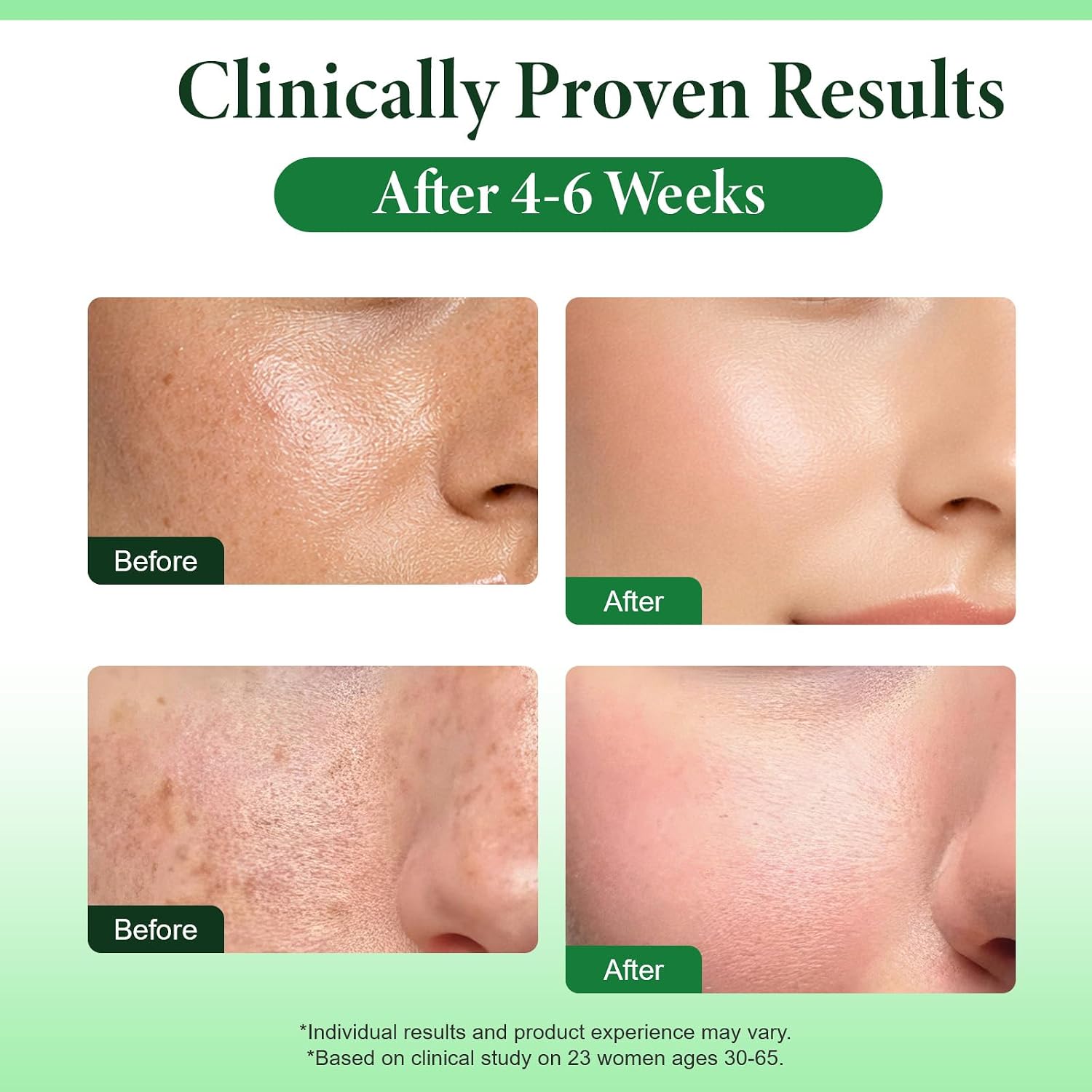 Dark Spot Remover for Face & Body with N... 2 Dark Spot Remover for Face & Body with N... - Image 2