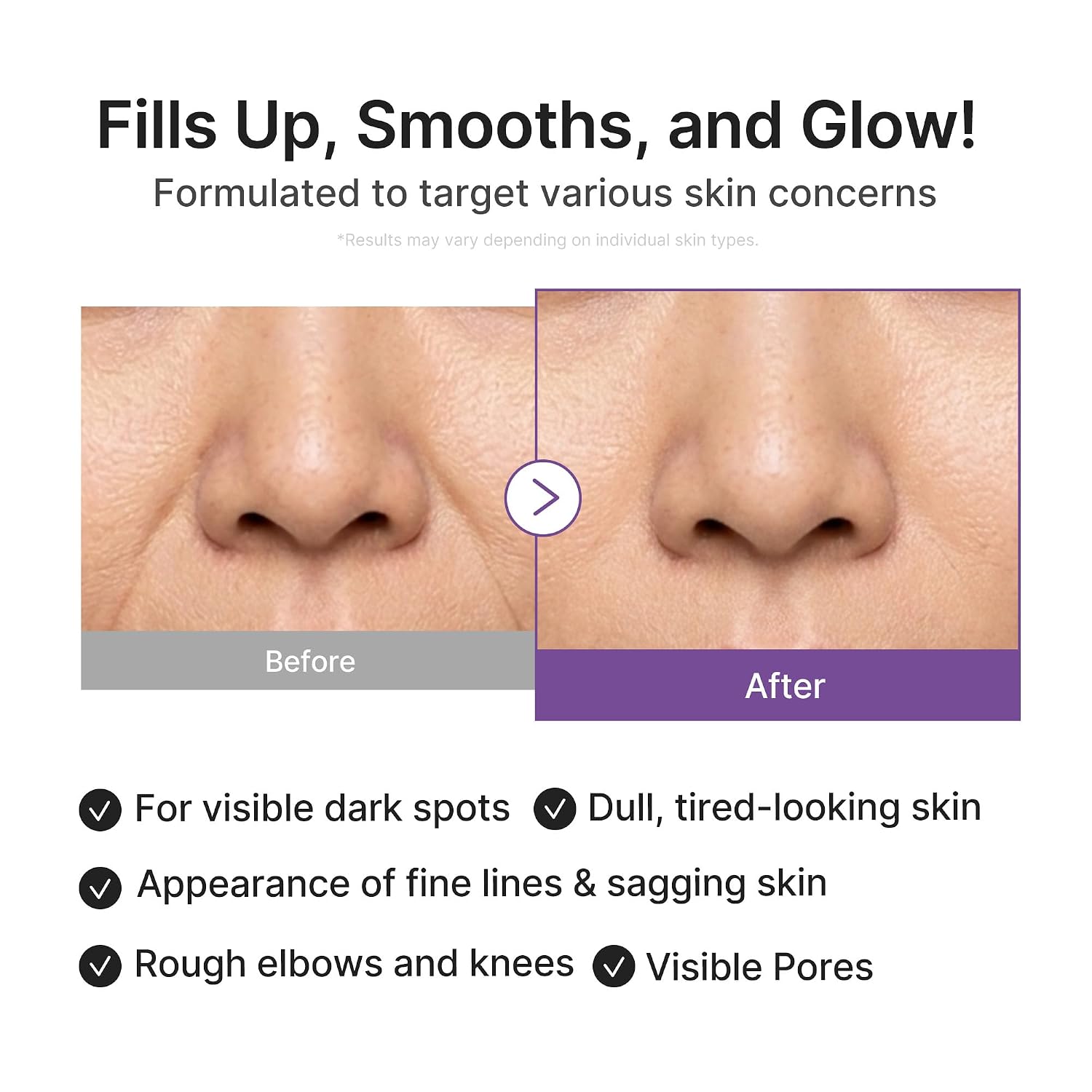 medicube Retinol Boosting Serum for Inte... 4 medicube Retinol Boosting Serum for Inte... - Image 4